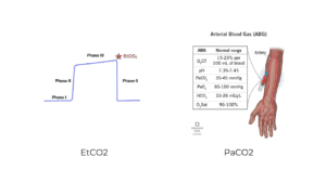 Benefits of EtCO2 over PaCO2